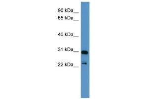 WB Suggested Anti-PHOX2A Antibody Titration: 0.