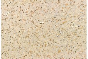 ABIN6260789 and ABIN6272910 at 1/100 staining Rat brain tissue by IHC-P. (CHCHD2 anticorps  (Internal Region))