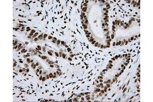 Image no. 8 for anti-Aryl Hydrocarbon Receptor Nuclear Translocator (ARNT) antibody (ABIN1496729) (ARNT anticorps)