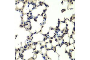 Immunohistochemistry of paraffin-embedded mouse lung using PSMD13 antibody.