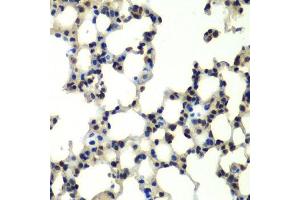 Immunohistochemistry of paraffin-embedded mouse lung using PSMD13 antibody. (PSMD13 anticorps  (AA 1-250))