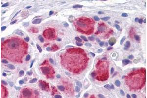 Human Ganglion cells: Formalin-Fixed, Paraffin-Embedded (FFPE) (DARS anticorps  (AA 393-501))