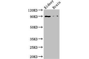 Western Blot Positive WB detected in: Mouse kidney tissue, Mouse brain tissue All lanes: IL4 antibody at 3 μg/mL Secondary Goat polyclonal to rabbit IgG at 1/50000 dilution Predicted band size: 18, 16 kDa Observed band size: 90 kDa