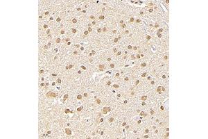 Immunohistochemistry of paraffin embedded rat brain using NSFL1C (ABIN7074865) at dilution of 1:700 (400x lens)