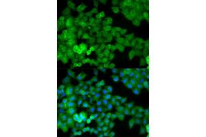 Immunofluorescence analysis of HeLa cells using JUP antibody.
