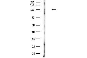 anti-Dynamin 3 (DNM3) (C-Term) antibody