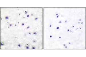 Immunohistochemistry analysis of paraffin-embedded human brain tissue, using Trk A (Ab-791) Antibody. (TRKA anticorps  (AA 747-796))