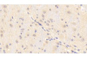 Detection of TRPM7 in Rat Cerebrum Tissue using Polyclonal Antibody to Transient Receptor Potential Cation Channel Subfamily M, Member 7 (TRPM7)