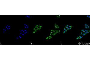 Immunocytochemistry/Immunofluorescence analysis using Rabbit Anti-p53 Polyclonal Antibody . (p53 anticorps  (C-Term) (PerCP))