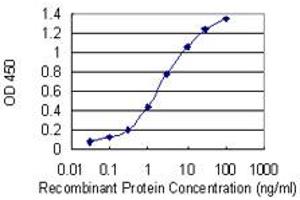 Detection limit for recombinant GST tagged MTSS1 is 0.
