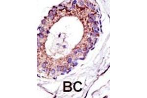 Immunohistochemistry (IHC) image for anti-Ubiquitination Factor E4A (UBE4A) antibody (ABIN3001447) (UBE4A anticorps)