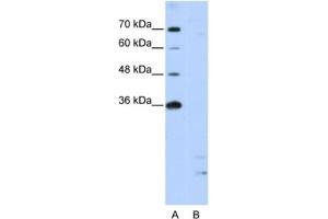 Western Blotting (WB) image for anti-Peptidylprolyl Isomerase E (Cyclophilin E) (PPIE) antibody (ABIN2462198) (PPIE anticorps)