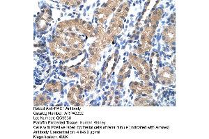 Rabbit Anti-RAE1 Antibody  Paraffin Embedded Tissue: Human Kidney Cellular Data: Epithelial cells of renal tubule Antibody Concentration: 4. (RAE1 anticorps  (C-Term))