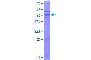 Image no. 1 for Sphingosine-1-Phosphate Phosphatase 2 (SGPP2) (AA 1-399) protein (GST tag) (ABIN1319844)