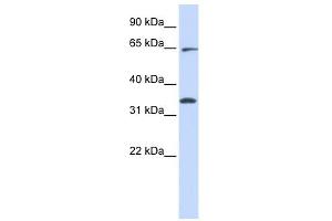 RHOT1 antibody used at 1 ug/ml to detect target protein.