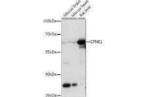 Western blot analysis of extracts of various cell lines, using CPNE1 antibody (ABIN7266499) at 1:1000 dilution.