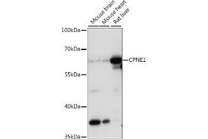 Western blot analysis of extracts of various cell lines, using CPNE1 antibody (ABIN7266499) at 1:1000 dilution. (CPNE1 anticorps  (AA 120-220))