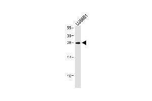 Anti-IGLL5 Antibody (C-term) at 1:1000 dilution + U266B1 whole cell lysate Lysates/proteins at 20 μg per lane. (IGLL5 anticorps  (C-Term))