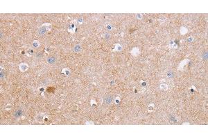 Immunohistochemistry of paraffin-embedded Human brain tissue using CDC7 Polyclonal Antibody at dilution 1:50 (CDC7 anticorps)
