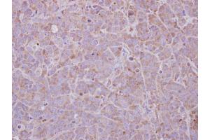 IHC-P Image MAGEB1 antibody detects MAGEB1 protein at cytosol on MCF-7 xenograft by immunohistochemical analysis.
