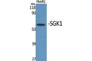 Western Blot (WB) analysis of specific cells using SGK1 Polyclonal Antibody. (SGK1 anticorps  (Tyr1062))