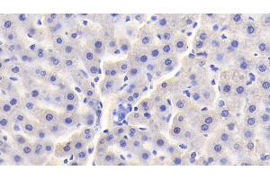 Detection of vHL in Rat Liver Tissue using Polyclonal Antibody to Von Hippel Lindau Tumor Suppressor (vHL) (VHL anticorps  (AA 6-175))