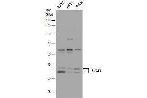 WB Image SUGT1 antibody detects SUGT1 protein by western blot analysis. (SUGT1 anticorps  (Center))