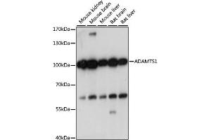 Western blot analysis of extracts of various cell lines, using  antibody (ABIN7265439) at 1:1000 dilution. (ADAMTS1 anticorps  (AA 718-967))