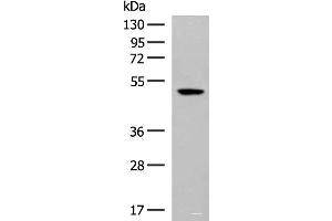 Western blot analysis of Hela cell lysate using GPR142 Polyclonal Antibody at dilution of 1:400 (GPR142 anticorps)