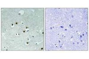Immunohistochemistry analysis of paraffin-embedded human braina tissue using HP1 alpha (Ab-92) antibody.