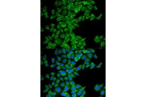 Immunofluorescence analysis of MCF-7 cell using DIABLO antibody. (DIABLO anticorps  (AA 1-232))