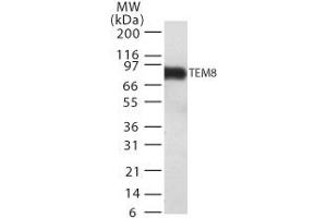 Image no. 1 for anti-anthrax Toxin Receptor 1 (ANTXR1) (AA 481-497) antibody (ABIN208216) (ANTXR1 anticorps  (AA 481-497))