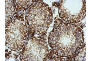 IHC-P Image Immunohistochemical analysis of paraffin-embedded mouse testis, using KCNG4, antibody at 1:500 dilution.