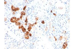 Formalin-fixed, paraffin-embedded human Kidney stained with Calbindin 1 Mouse Monoclonal Antibody (CALB1/2782).