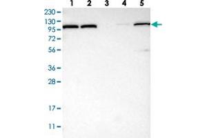 Western blot analysis of Lane 1: RT-4, Lane 2: U-251 MG, Lane 3: Human Plasma, Lane 4: Liver, Lane 5: Tonsil with OGDH polyclonal antibody  at 1:250-1:500 dilution. (alpha KGDHC anticorps)