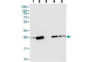 Western blot analysis of Lane 1: RT-4, Lane 2: U-251 MG, Lane 3: Human Plasma, Lane 4: Liver, Lane 5: Tonsil with CRIP2 polyclonal antibody  at 1:250-1:500 dilution. (CRIP2 anticorps)