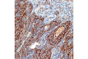 Immunohistochemistry of paraffin-embedded rat ovary using PRKB Rabbit mAb (ABIN7269663) at dilution of 1:100 (40x lens). (PRKAR2B anticorps)