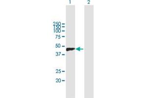 Western Blot analysis of VCAN expression in transfected 293T cell line by VCAN MaxPab polyclonal antibody. (Versican anticorps  (AA 1-354))