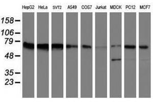 Image no. 14 for anti-Fragile X Mental Retardation 1 (FMR1) (AA 36-279) antibody (ABIN1491454)