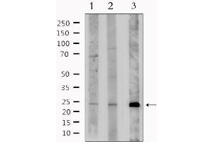 Western blot analysis of extracts from various samples, using BNIP3L Antibody. (BNIP3L/NIX anticorps  (Internal Region))
