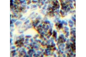 Used in DAB staining on fromalin fixed paraffin-embedded Spleen tissue (CFP anticorps  (AA 315-469))