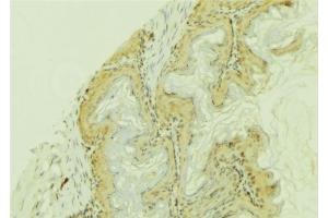 ABIN6273744 at 1/100 staining Mouse colon tissue by IHC-P. (CYP4F12 anticorps)