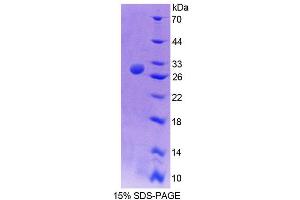 SDS-PAGE analysis of Mouse TCEA2 Protein. (TCEA2 Protéine)