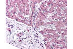Immunohistochemistry (IHC) image for anti-Peroxisome Proliferator-Activated Receptor alpha (PPARA) antibody (ABIN2476187)