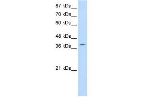 MYST4 antibody used at 0. (KAT6B anticorps  (N-Term))