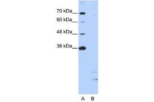 WB Suggested Anti-PPIE  Antibody Titration: 2. (PPIE anticorps  (Middle Region))