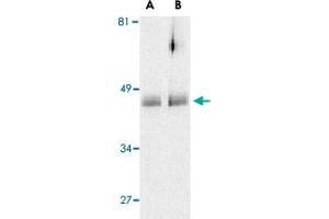 Western blot analysis of HTRA2 in human colon cell lysates with HTRA2 polyclonal antibody  at (A) 0.