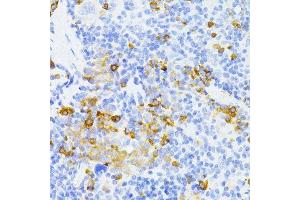 Immunohistochemistry of paraffin-embedded mouse spleen using MMP2 antibody.