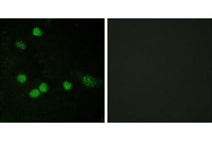 Peptide - +Immunofluorescence analysis of HeLa cells, using Raf1 (Ab-621) antibody. (RAF1 anticorps  (Ser621))