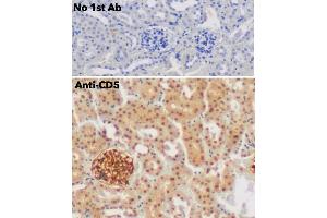 Immunohistochemistry (IHC) image for anti-CD5 (CD5) (AA 105-210) antibody (ABIN7272988) (CD5 anticorps  (AA 105-210))
